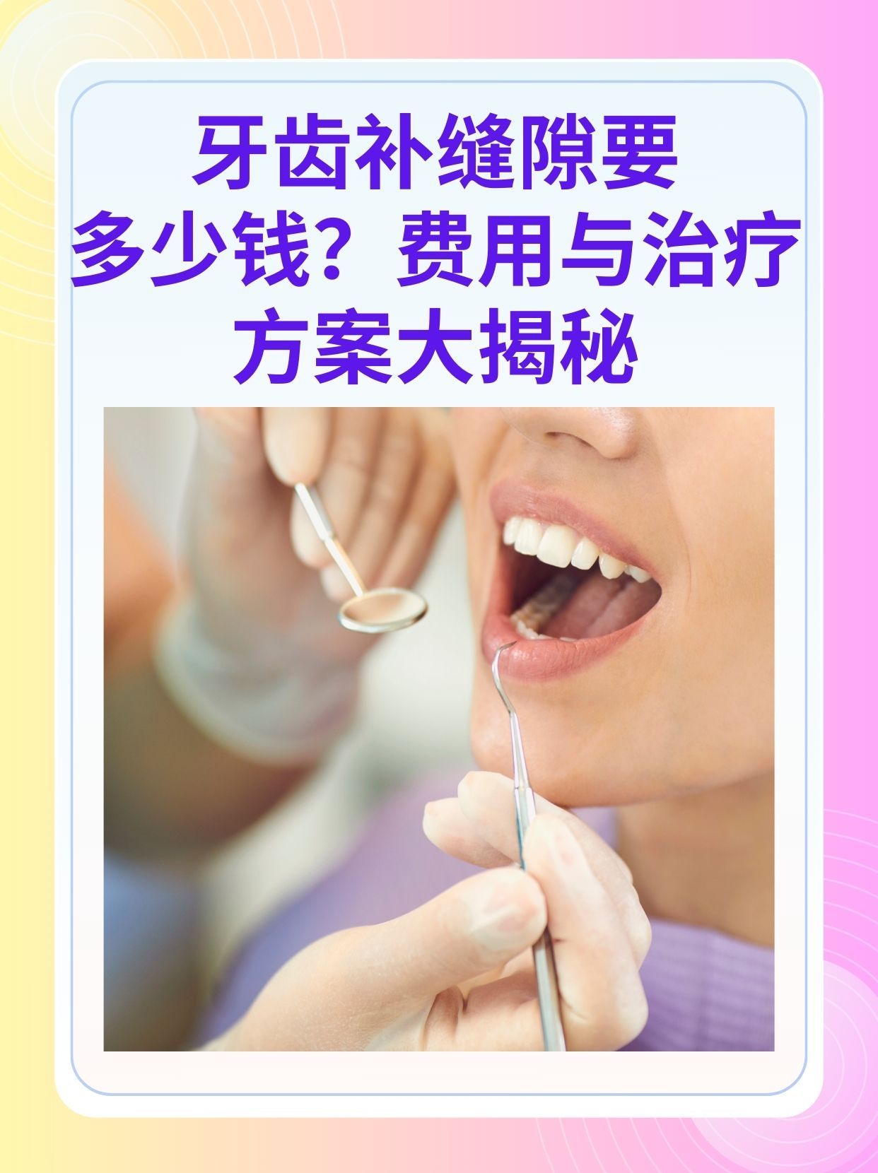 六盘水补牙医保可以报销吗(补牙医保可以报销吗 哪些可以报销呢)